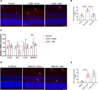 Lycium ruthenicum water extract preserves retinal ganglion cells in chronic ocular hypertension mouse models